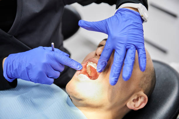 Best Emergency Gum Treatment in Renton, WA